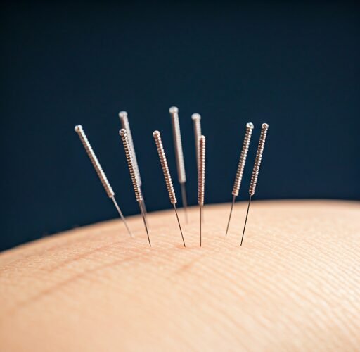 Service — Acupuncture
