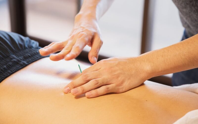 Dry needling therapy for myofascial trigger points